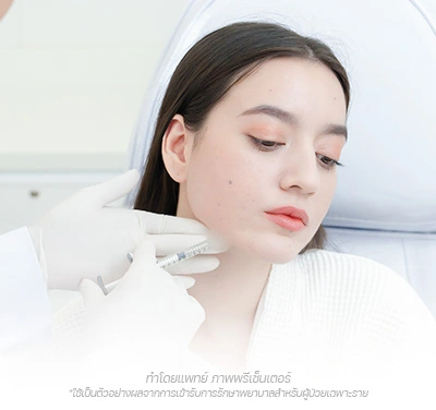 4D Face Lifting