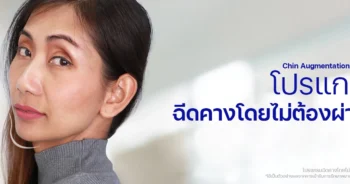 ฟิลเลอร์คาง
