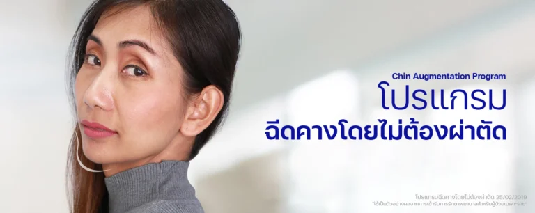 ฟิลเลอร์คาง