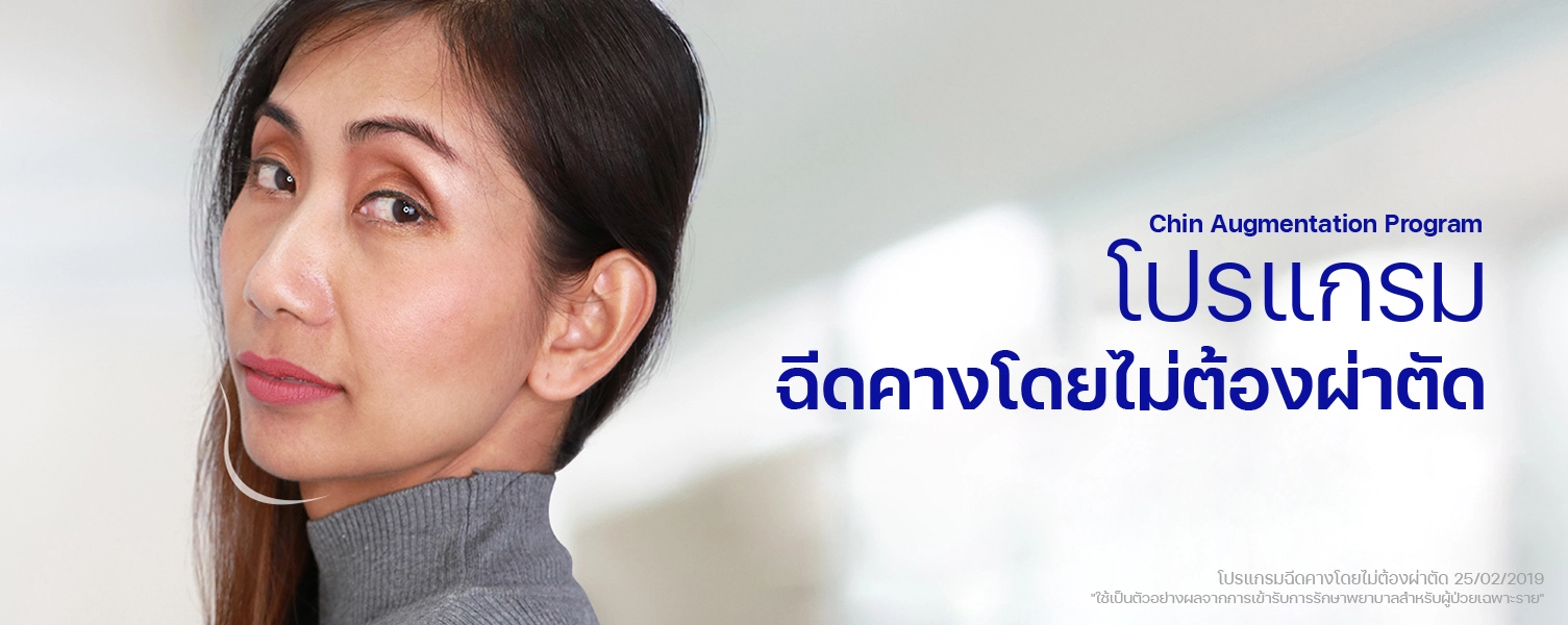 ฟิลเลอร์คาง