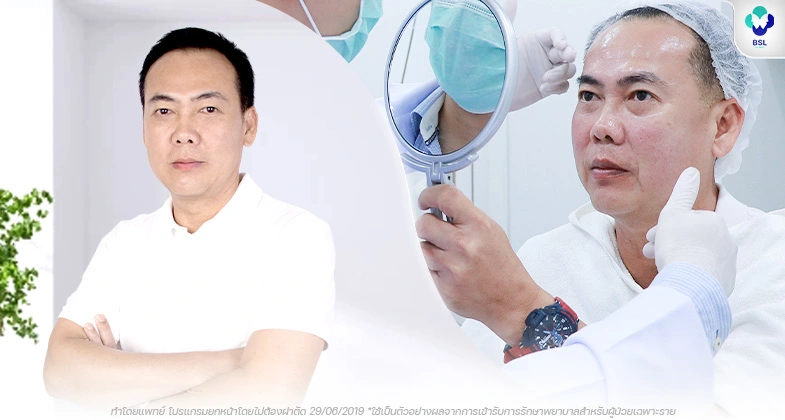 รีวิวยกกระชับโดยไม่ต้องผ่าตัด