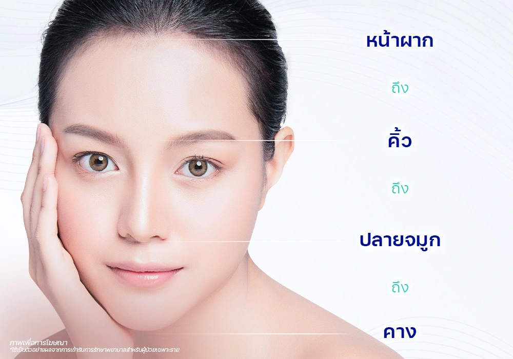 สัดส่วนใบหน้า เสริมคาง ฟิลเลอร์คาง