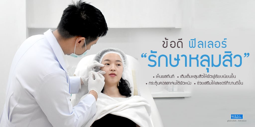 ข้อดีฟิลเลอร์รักษา หลุมสิว