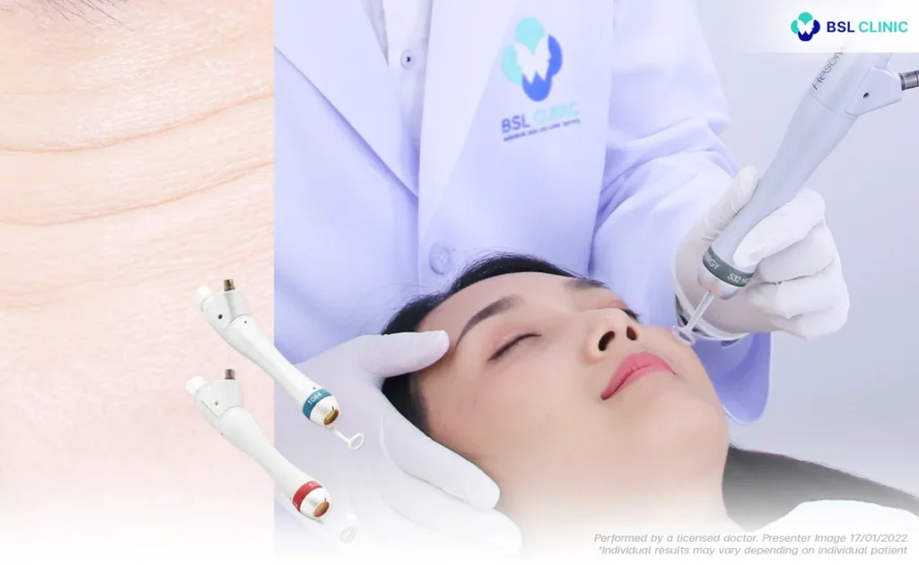 PicoWay-Wrinkles-Fine-Lines-Large-pores-Uneven-skin-texture-and-tone