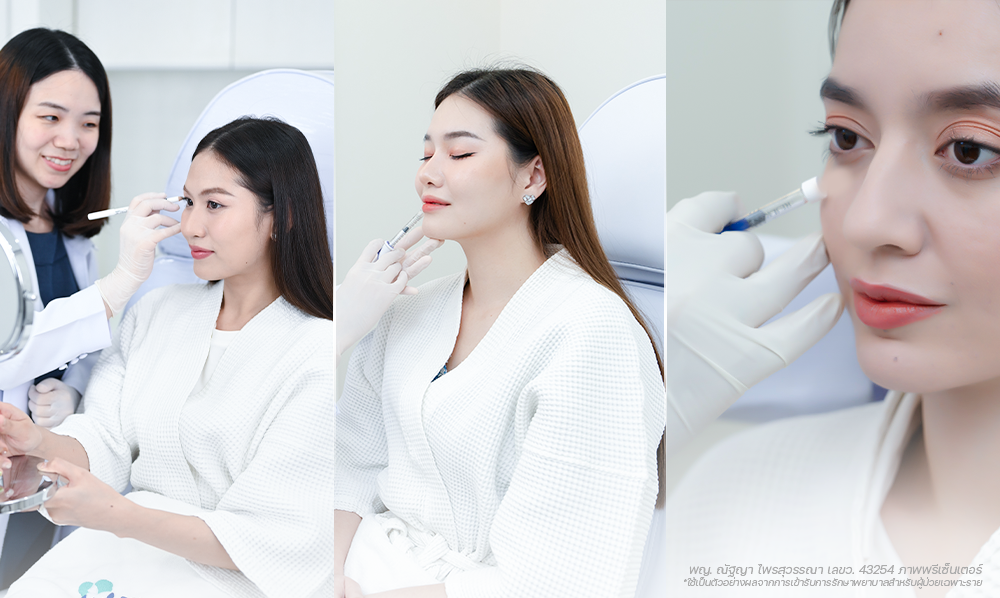 Dermal-Filler-โปรแกรมฟิลเลอร์-ลดเลือนริ้วรอย