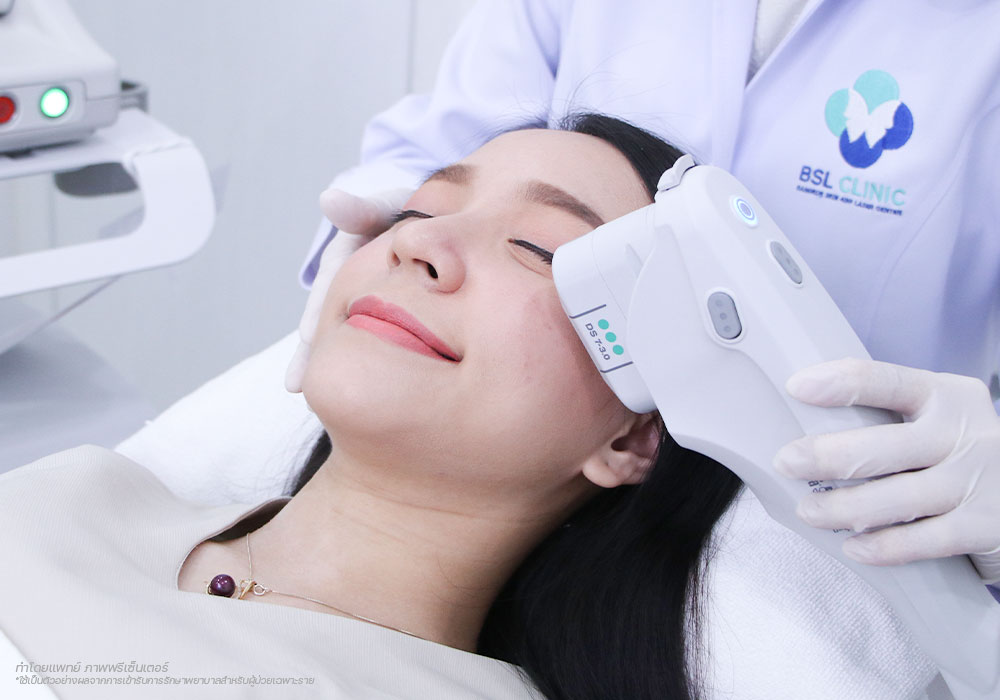 Ulthera-แก้ปัญหาผิวหนังรอบดวงตา--Eyes-Wrinkle-ปัญหาผิว-รอบดวงตา