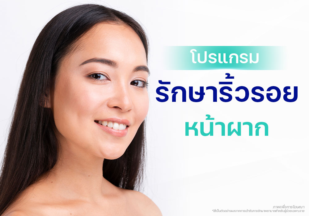 รูปโมเดล แบนเนอร์ รักษาริ้วรอยหน้าผาก แก้ไขปัญหาหน้าผากแบน