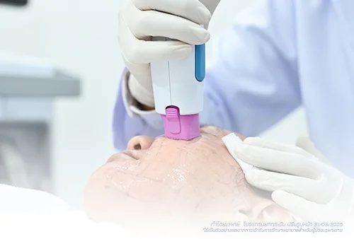 เทคโนโลยียกกระชับ thermage