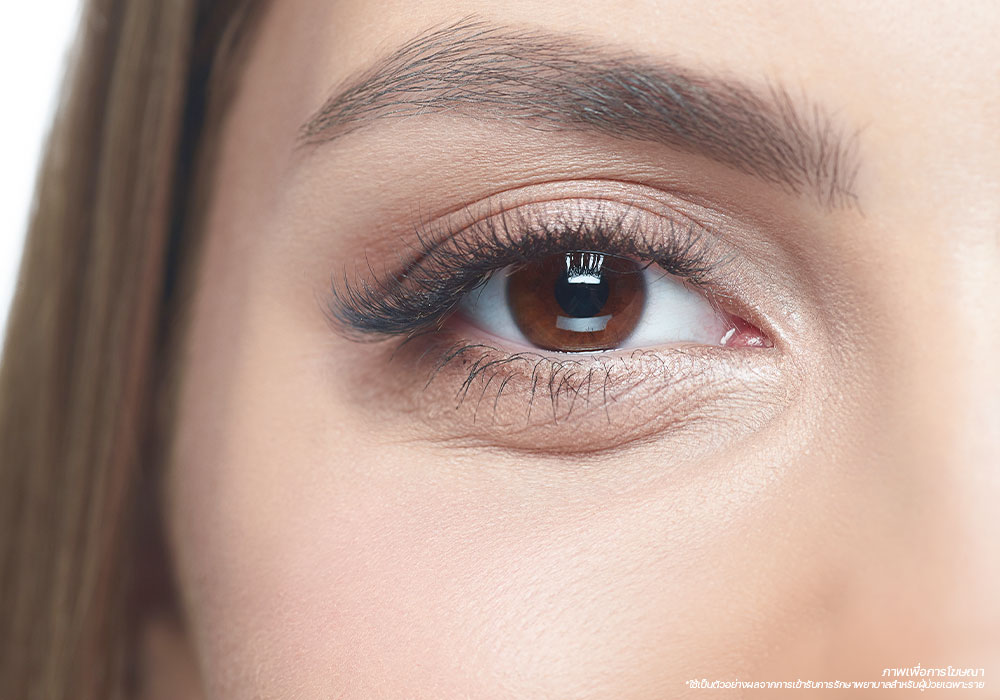 ปัญหาผิว-รอบดวงตา-ถุงใต้ตา-ร่องใต้ตา---Eyes-Wrinkle-ปัญหาผิว-รอบดวงตา
