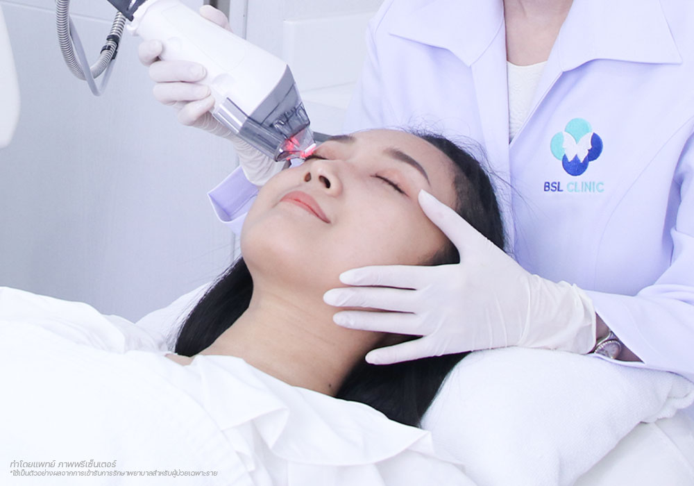 วิธีการรักษา-รอบดวงตา-กับริ้วรอยที่มากขึ้น--Eyes-Wrinkle-ปัญหาผิว-รอบดวงตา