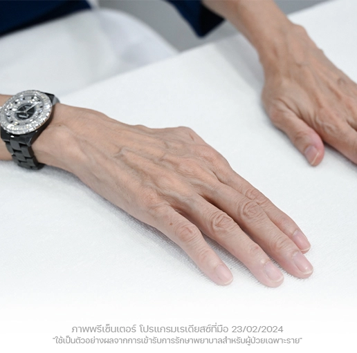 ประเมินผิว