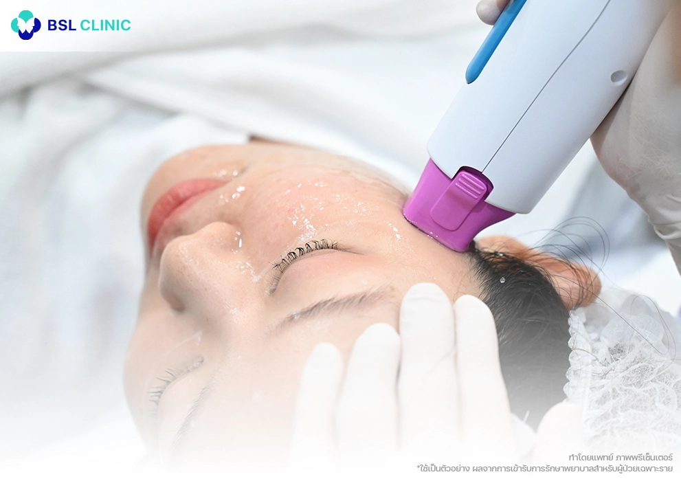 Thermage Program bsl clinic