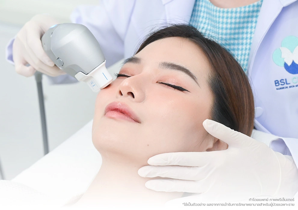 face lift Ultraformer III Program bsl clinic