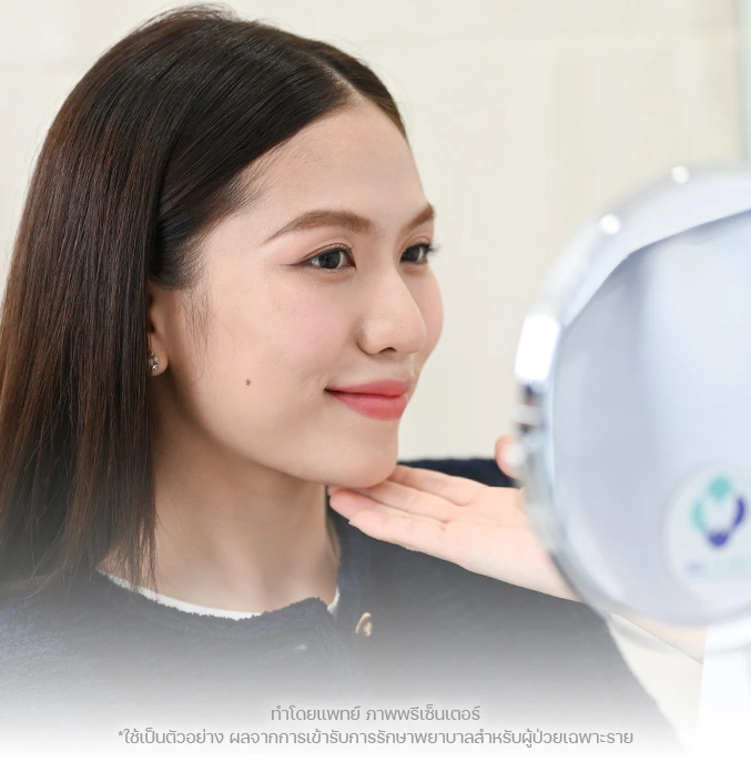 face lift ผิวยกกระชับขึ้น bslclinic