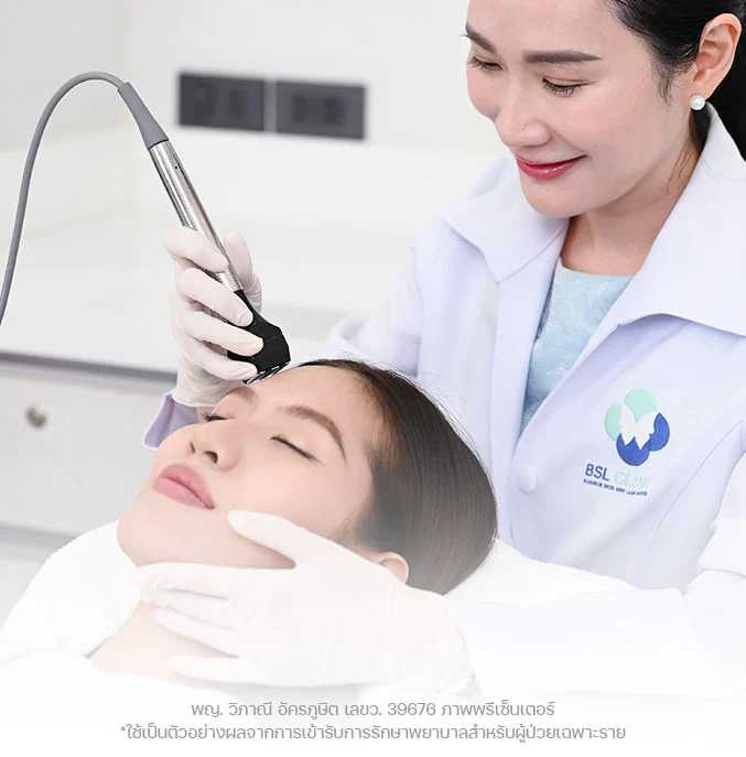 forma face lift ผิวยกกระชับขึ้น