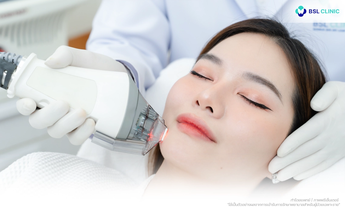 Ulthera-Prime-Program-Fraxel-Dual-Laser-Program