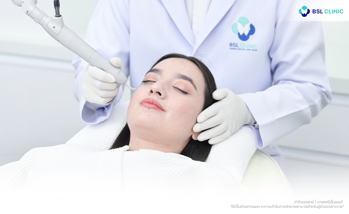 Ulthera-Prime-Program-PicoWay-Laser-Program