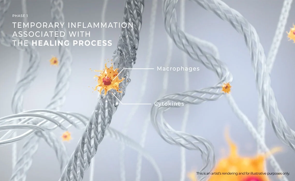 phase-1-healing-response-collagen-renewal