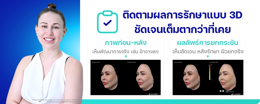 Ulthera-Prime-Program-วิเคราะห์ผิว-3D