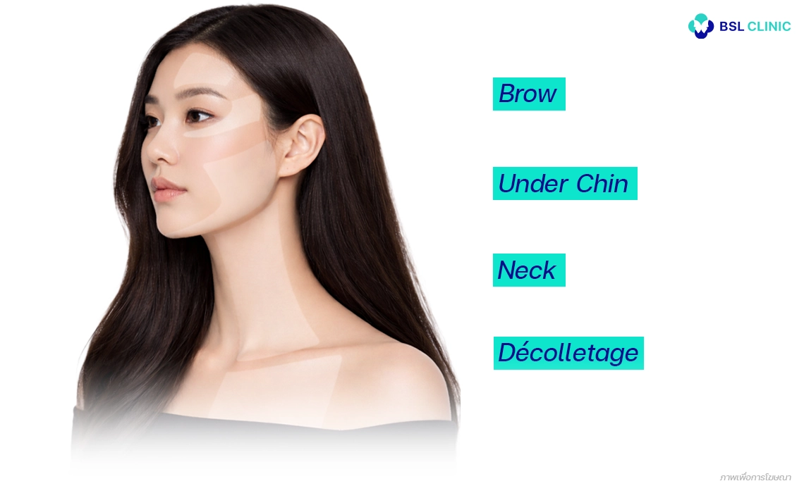 Ulthera-Prime-Program-ทำบริเวณใดได้บ้าง